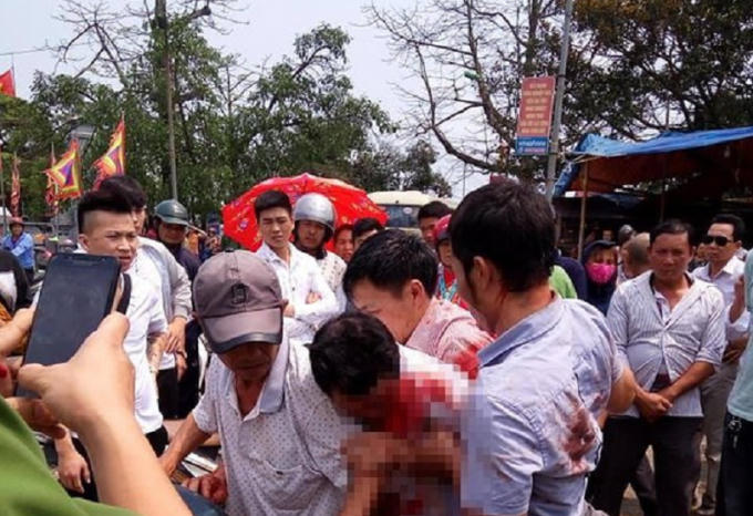 Ông T. bị nhóm người đánh trọng thương được mọi người đưa đến bệnh viện cấp cứu.