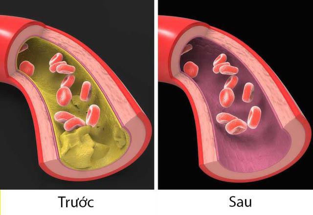 Cơ thể bạn sẽ ra sao khi uống dầu c&aacute; h&agrave;ng ng&agrave;y?