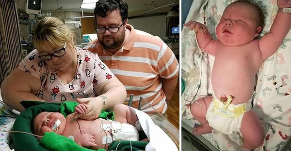 B&eacute; sơ sinh nặng gần 6,7 kg