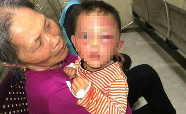 Cháu Hồ Phúc Hiếu bị chấn thương nặng vùng mặt. (Ảnh: báo Một thế giới)
