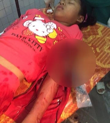 Hiện tình trạng sức khỏe của em D. đang dần phục hồi.