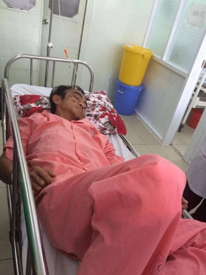 Ông Huỳnh Văn Nén khi đang cấp cứu.