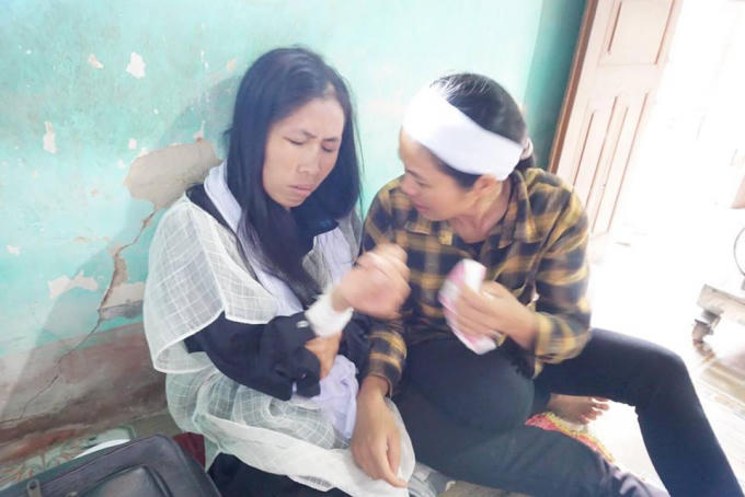 Chị Nguyệt trên tay còn thương tích đau đớn sau cái chết của chồng và con trai.