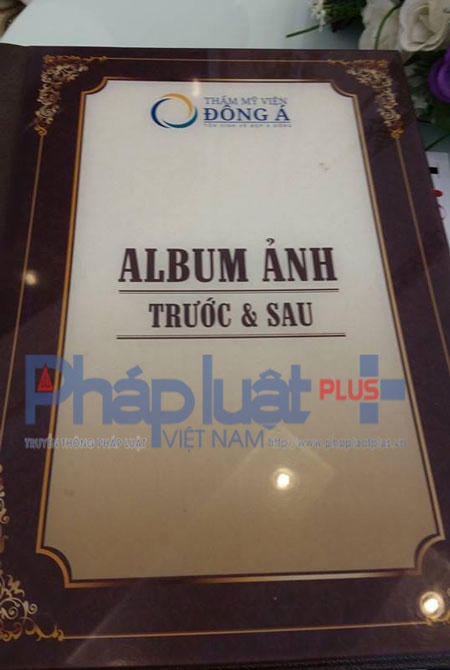 Album có những hình ảnh phẫu thuật nâng ngực, mông, đùi, hút mỡ bụng của Thẩm mỹ viện Đông Á.