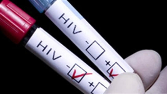 Cơ sở thực hiện xét nghiệm sàng lọc HIV phải có ít nhất 1 nhân viên xét nghiệm có chứng chỉ hành nghề thuộc phạm vi chuyên môn về xét nghiệm. Ảnh: minh họa