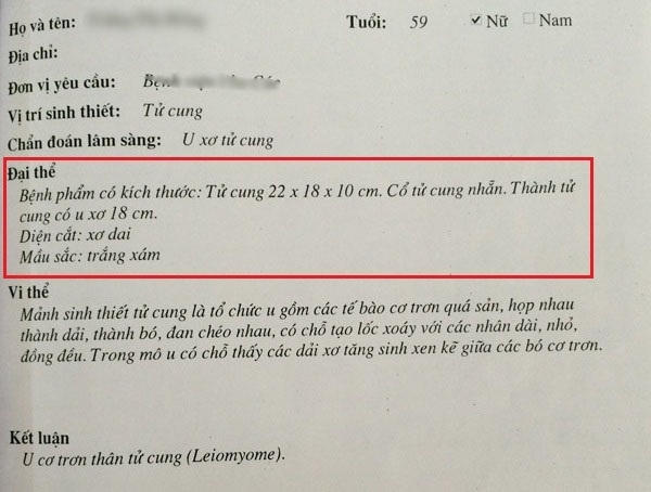 Kết quả giải phẫu của bà H được khám tại một bệnh viện đa khoa tại Hà Nội. Ảnh: Bệnh viện cung cấp.