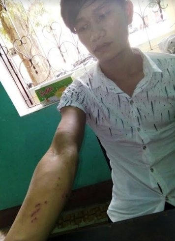 Dù bị chống trả quyết liệt, đối tượng vẫn thực hiện hành vi đồi bại.