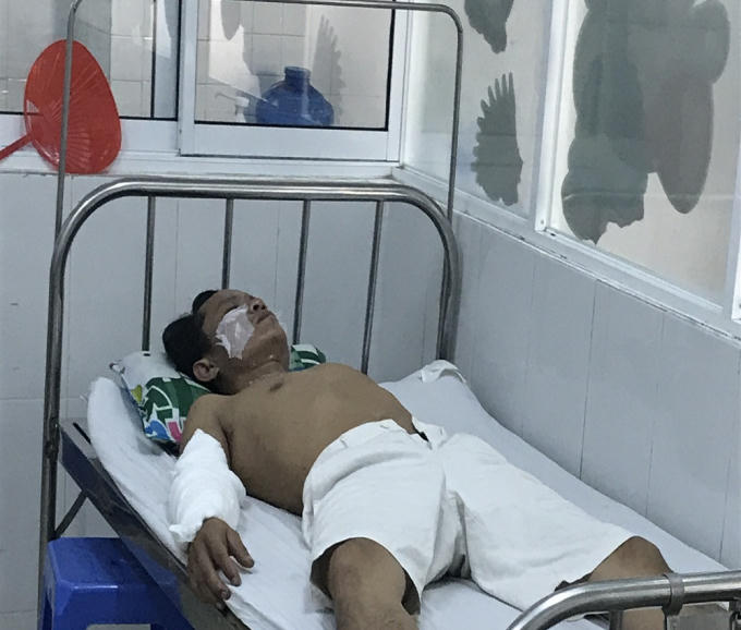 Một trong 4 công nhân đang nằm điều trị tại bệnh viện. Ảnh: TT.