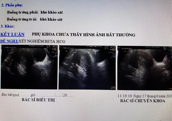 Kết quả siêu âm cho thấy chị D. không hề có thai