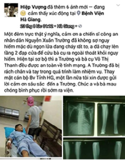 Sau khi c&acirc;u chuyện của anh Trường được một b&aacute;c sĩ c&ocirc;ng t&aacute;c tại Bệnh viện Đa khoa tỉnh H&agrave; Giang chia sẻ tr&ecirc;n mạng x&atilde; hội Facebook, cộng đồng mạng đ&atilde; d&agrave;nh những lời khen đặc biệt cho vị Thượng &uacute;y c&ocirc;ng an.