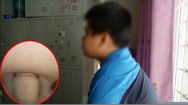 Bé K. đang được chăm sóc tại Ngôi nhà bình yên  Ảnh Trần Cường