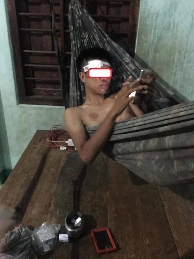 Hậu quả mà 2 thanh niên này phải gánh chịu.