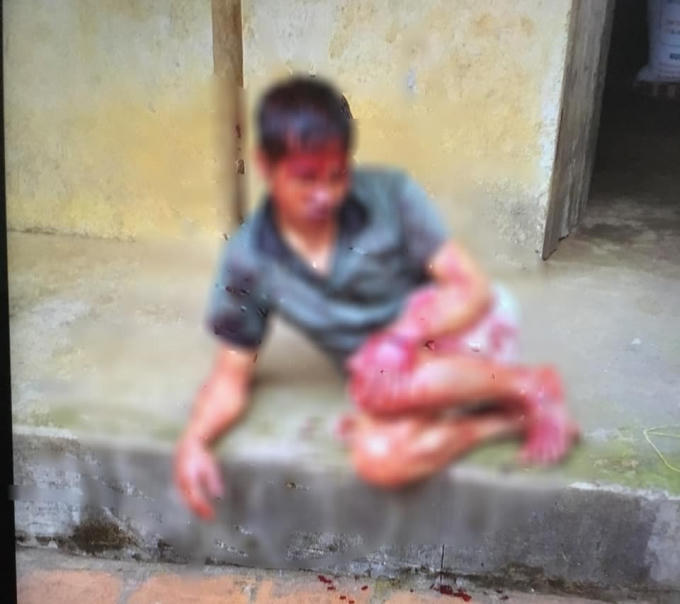 Anh D. bị hàng xóm chém trọng thương.