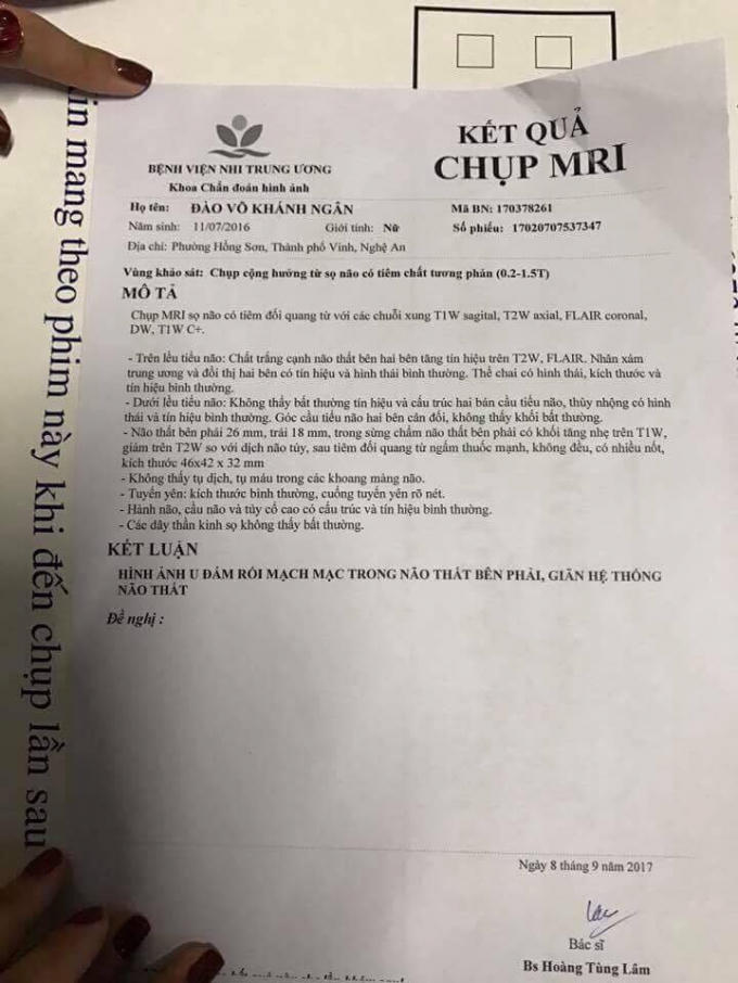 Kết quả chụp MRI của bé Khánh Ngân.