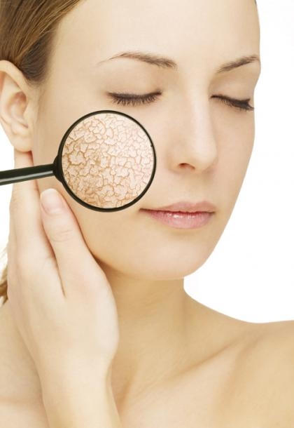 Da khô thường dễ xỉn màu và lão hóa. Anhr: internet.