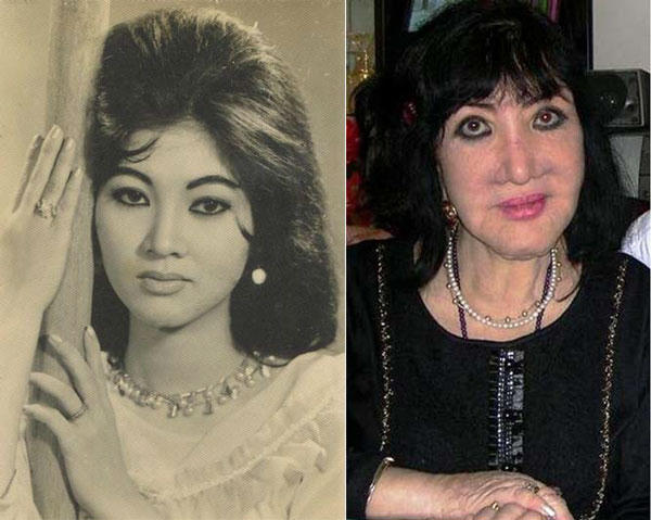 Tuyệt sắc giai nhân một thời, minh tinh Thẩm Thúy Hằng và hình ảnh khi về già với nhiều biến chứng sau phẫu thuật thẩm mỹ...