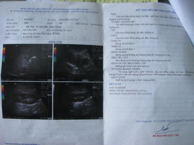 Kết quả siêu âm bệnh của bà Tốt.