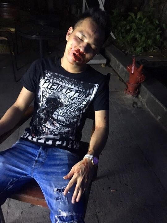 Anh Nguyễn Thành Chung (SN 1987) bị đánh tại Q Club.