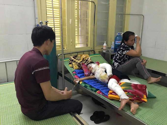 Bé trai bị bỏng nặng toàn thân, hiện đang được điều trị tại bệnh viện.