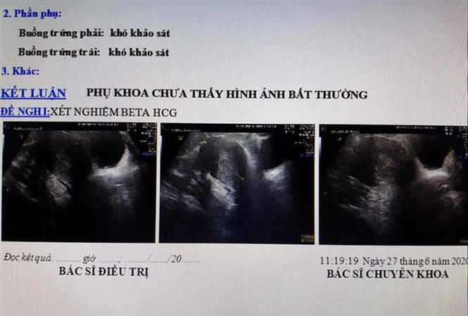 Anh98.