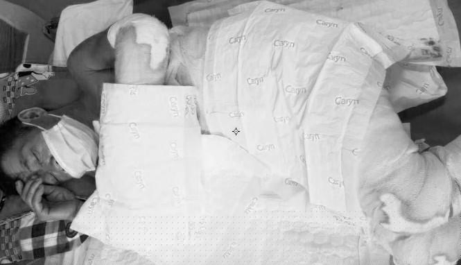 Ông Thiện đang tích cực cấp cứu tại bệnh viện đa khoa Lạng Sơn nhưng tiên lượng xấu, nguy cơ đến tử vong. Ảnh: ĐK