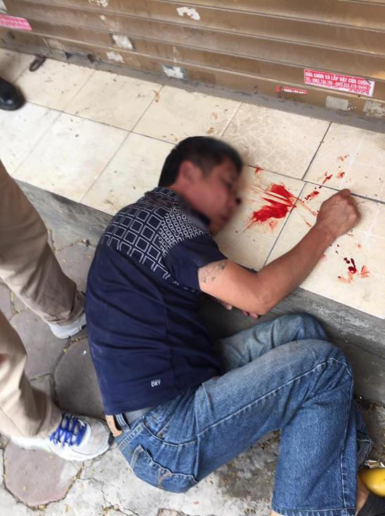 Một trong ba người đàn ông bị đánh ngất lịm tại chỗ (ảnh mạng xã hội).