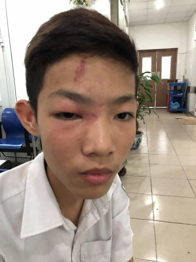 Nguyễn Bách tại cơ sở y tế.