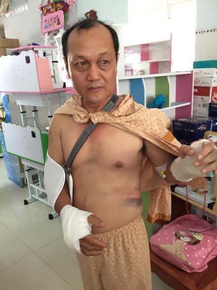 Nạn nhân nhập viện điều trị sau khi bị tấn công.
