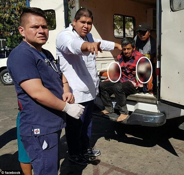 Nhân viên gánh xiếc - ông Cipriano Alvarez (55 tuổi) - đã bị mất cả hai cánh tay sau khi bị tấn công bởi những con hổ mà hàng ngày ông vẫn cho ăn. Những con hổ nằm trong chiếc chuồng tạm với các song sắt có khoảng cách rộng, có thể luồn cánh tay qua. Trong ảnh, ông Cipriano đang được đưa tới bệnh viện.