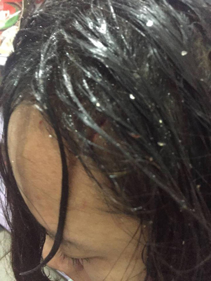 Nữ nhân viên bị ném chảy máu đầu.