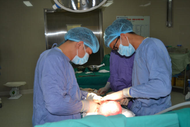 Khối u xơ to như thai 5 tháng trong tử cung người phụ nữ