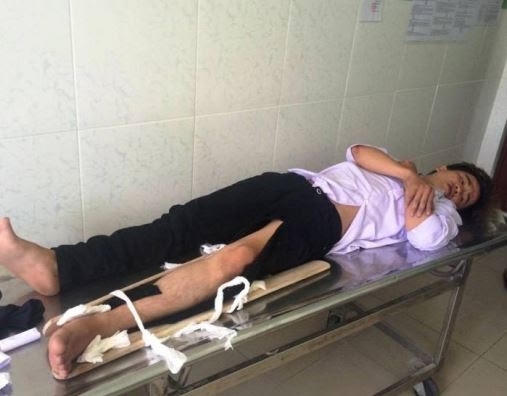 Đối tượng Bùi Thanh Ẩn đang điều trị tại bệnh viện.