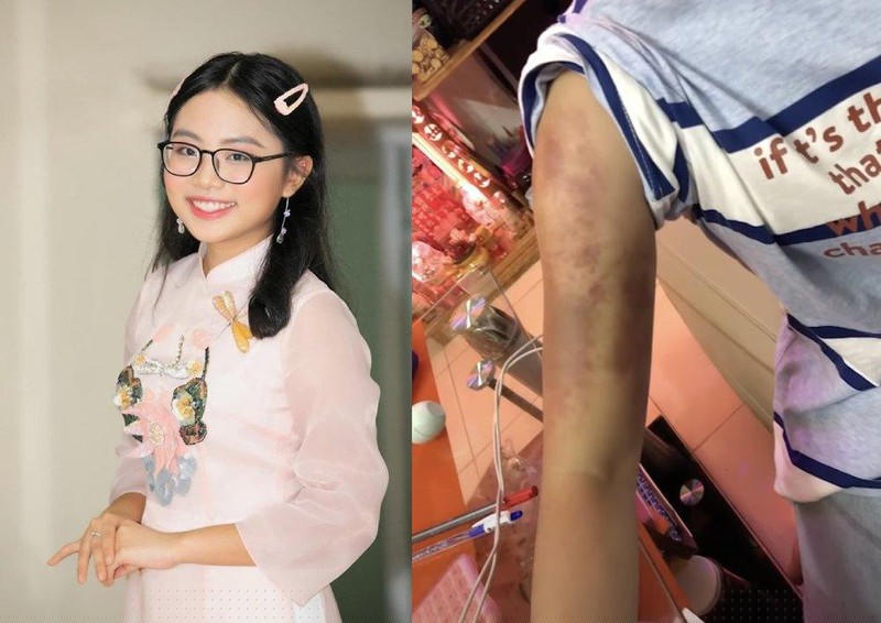 Thời gian đó, Phương Mỹ Chi không giảm được cân nào lại gây hại đến cơ thể. (Ảnh: FB Phương Mỹ Chi)