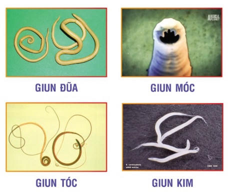 Những loại giun có thể tiêu diệt bằng thuốc. Ảnh minh họa/ nguồn: Internet.