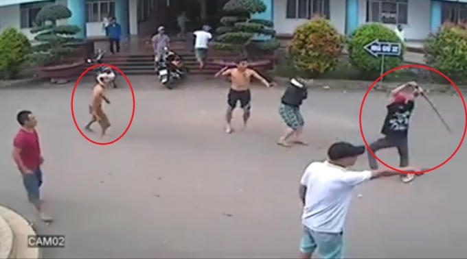 Thanh niên được cấp cứu tại bệnh viện vẫn hung hăng tham chiến.