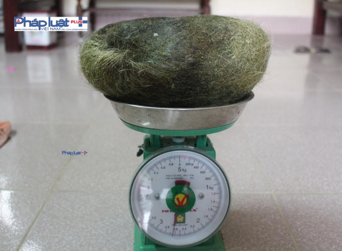 Vật thể lạ c&oacute; c&acirc;n nặng gần 2,8 kg (ảnh Văn Lịnh).