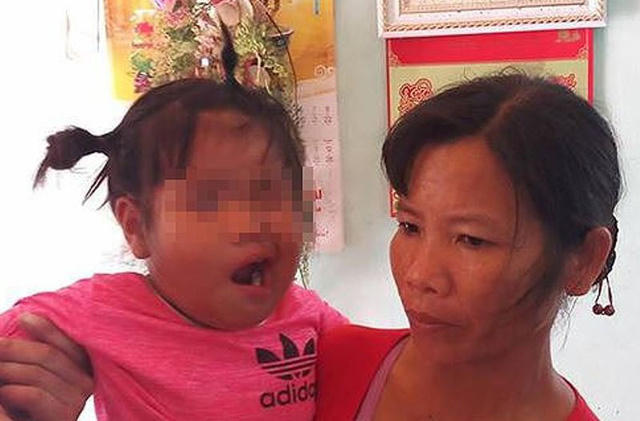 Hiện ngành giáo dục phối hợp với nhà trường, chính quyền địa phương và gia đình đưa cháu đến bệnh viện xác minh kỹ sự việc.