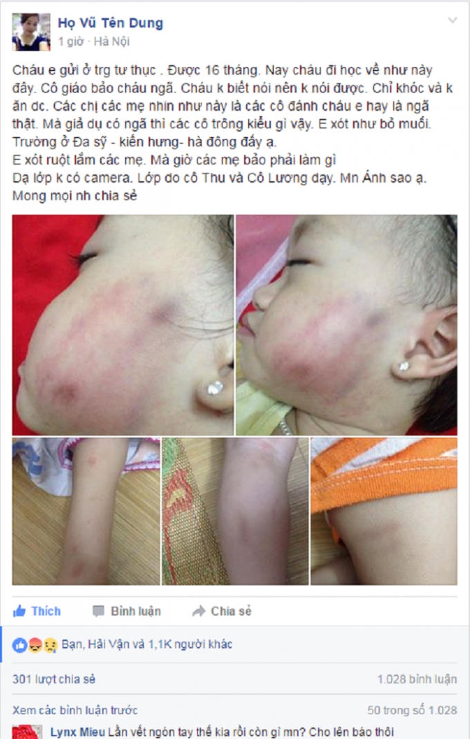 Câu chuyện kèm hình ảnh những vết thương của bé gái. (Nguồn: FBNV).