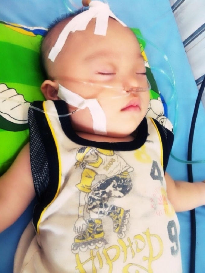 Bé Lò Viết Chung (6 tháng tuổi) đang nằm điều trị tại Khoa Hồi sức tim mạch, Bệnh viện Nhi Trung ương.