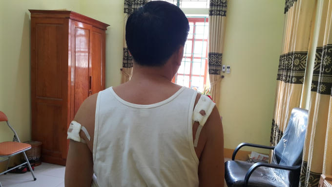 Ông Nguyễn Đình Thanh - Chủ tịch UBND xã Nghi Quang bị trúng 4 phát đạn vào người.