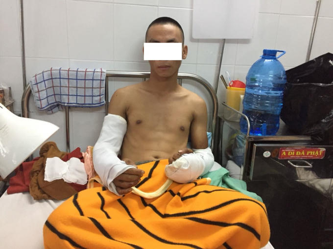 Nạn nhân Bùi V. T. bị chém đứt gân hai cánh tay