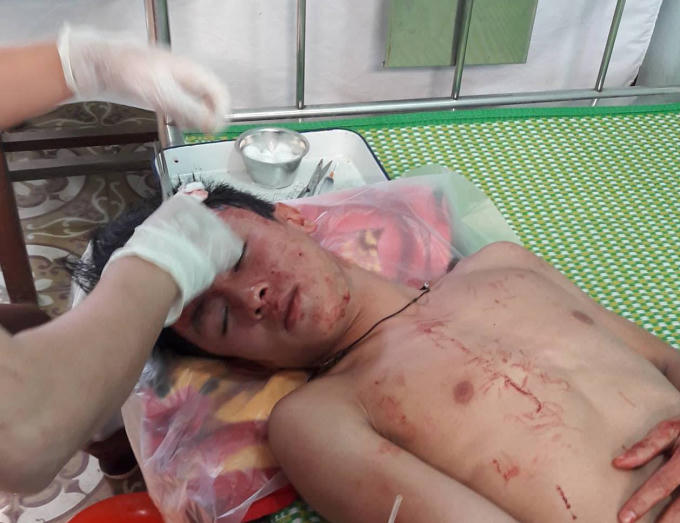 Học sinh bị thương được điều trị tại bệnh viện.