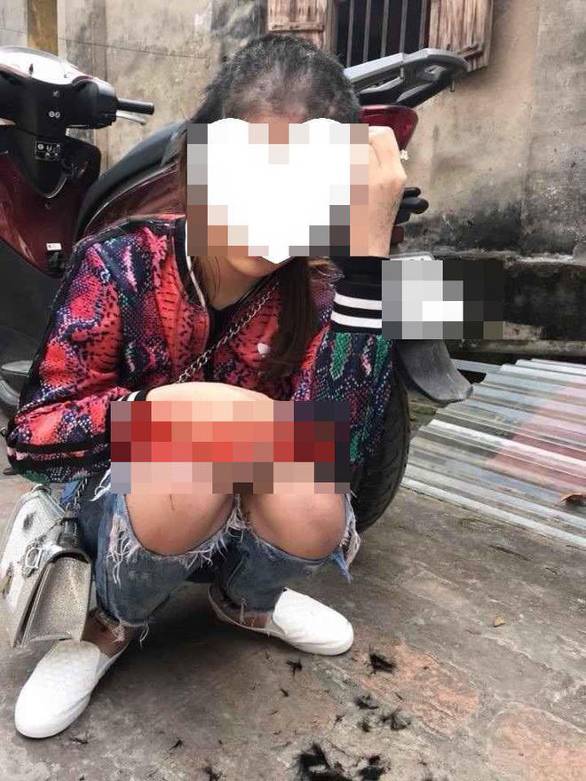 Hình ảnh gây ám ảnh của V. sau bị cắt tóc.