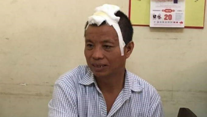 Anh7.