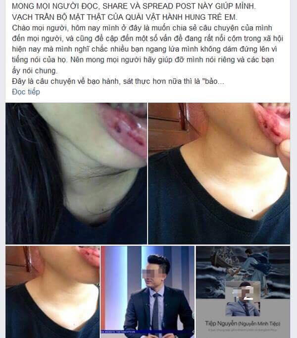Dòng chia sẻ trên facbook về câu chuyện nữ sinh tố bị anh rể là BTV Minh Tiệp bạo hành gây xôn xao. Ảnh: GĐXH