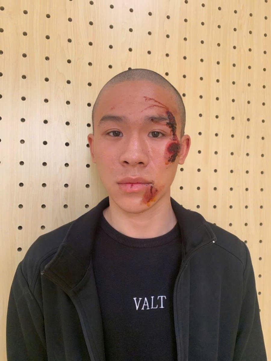 Đối tượng Nguyễn Anh Tuấn (SN 2007, trú tại Tổ dân phố Đầm Vạc, phường Vĩnh Phúc).