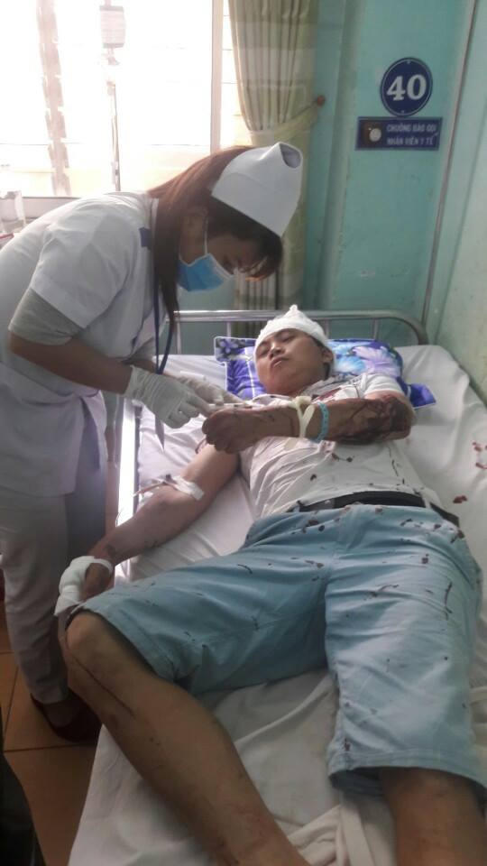 Vụ tai nạn thảm khốc ở Gia Lai: Nạn nh&acirc;n sống s&oacute;t kể lại gi&acirc;y ph&uacute;t đối mặt với c&aacute;i chết
