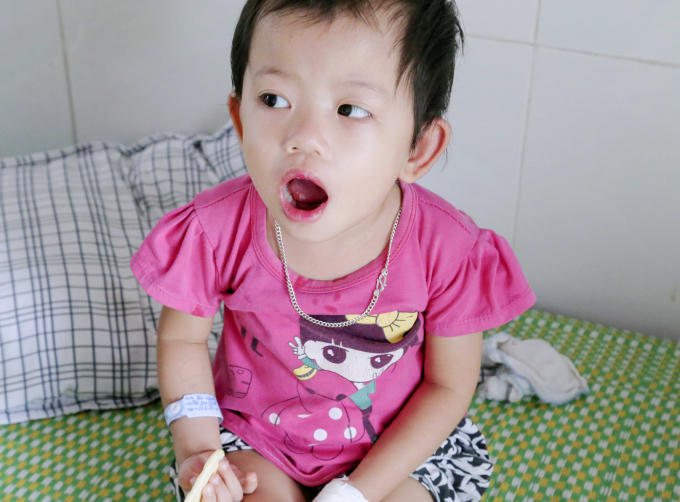 Bệnh nhi bị tay chân miệng đang được điều trị tại BV Đa khoa Phú Thọ