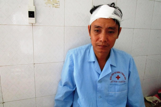 Anh Thiều Văn Hùng nạn nhân bị 2 thanh niên lạ mặt đánh.