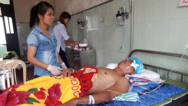 Ông B. đang tiếp tục được chăm sóc, theo dõi tại Bệnh viện ĐK huyện Nghi Xuân.